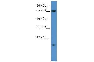 WB Suggested Anti-RHOXF1 Antibody Titration: 0. (RHOXF1 antibody  (C-Term))