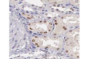 ABIN6267387 at 1/200 staining human kidney tissue sections by IHC-P. (ATF2 antibody  (pSer44, pSer62))