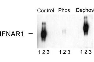 Image no. 1 for anti-Interferon alpha/beta Receptor 1 (IFNAR1) (pSer535), (pSer539) antibody (ABIN372660) (IFNAR1 antibody  (pSer535, pSer539))