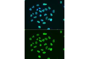 Immunofluorescence analysis of HeLa cell using H3K9ac antibody. (Histone 3 antibody  (H3K9ac))