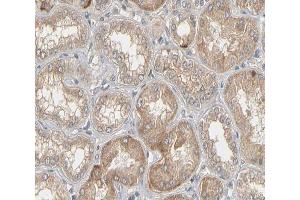 ABIN6266517 at 1/200 staining human kidney tissue sections by IHC-P. (Connexin 43/GJA1 antibody  (Internal Region))