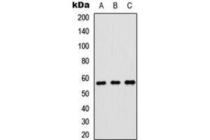 Western blot analysis of p57 Kip2 expression in HeLa (A), SHSY5Y (B), rat brain (C) whole cell lysates.