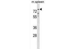 Western Blotting (WB) image for anti-Glypican 2 (GPC2) antibody (ABIN2998770)