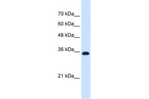 Western Blotting (WB) image for anti-ATPase, Na+/K+ Transporting, beta 1 Polypeptide (ATP1B1) antibody (ABIN2462815)