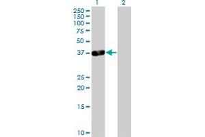 Western Blot analysis of PDLIM3 expression in transfected 293T cell line by PDLIM3 MaxPab polyclonal antibody. (PDLIM3 antibody  (AA 1-316))