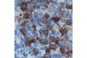 Immunohistochemical analysis of DOK2 staining in human lymph node formalin fixed paraffin embedded tissue section.