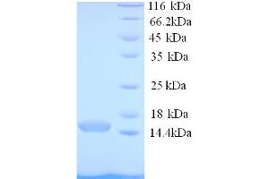 SDS-PAGE (SDS) image for Pterin-4 alpha-Carbinolamine Dehydratase/dimerization Cofactor of Hepatocyte Nuclear Factor 1 alpha (PCBD1) (AA 2-104) protein (His tag) (ABIN4975942)
