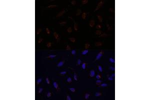 Immunofluorescence analysis of U-2 OS cells using  antibody (ABIN6131164, ABIN6136413, ABIN6136415 and ABIN6217209) at dilution of 1:100. (ACAT1 antibody  (AA 1-145))