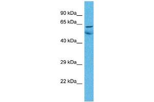 Host:  Rabbit  Target Name:  ZNF48  Sample Type:  Lung Tumor lysates  Antibody Dilution:  1. (ZNF48 antibody  (C-Term))
