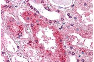 Human Kidney: Formalin-Fixed, Paraffin-Embedded (FFPE) (GM2A antibody  (C-Term))