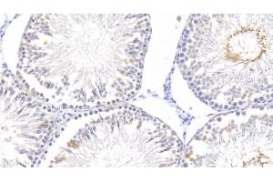 Immunohistochemistry (IHC) image for anti-Epidermal Growth Factor (EGF) (AA 974-1026) antibody (ABIN7427390)