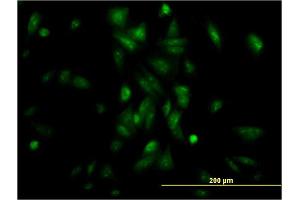Immunofluorescence of monoclonal antibody to NR1H4 on HepG2 cell. (NR1H4 antibody  (AA 363-472))