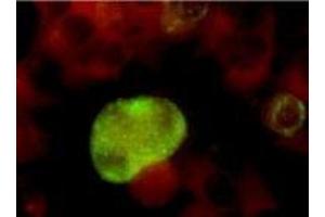 Immunofluorescence (IF) image for anti-Herpes Simplex Virus Type 2, Glycoprotein G (HSV2 gG) antibody (ABIN265564) (HSV-2 gG antibody)