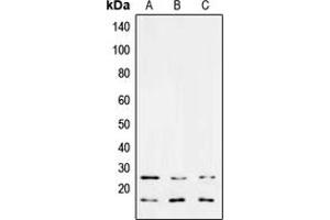 Western blot analysis of TGF beta 3 expression in MCF7 (A), NIH3T3 (B), PC12 (C) whole cell lysates. (TGFB3 antibody  (Center))