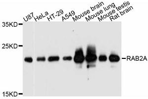 Western blot analysis of extracts of various cell lines, using RAB2A antibody (ABIN5998650) at 1:3000 dilution. (RAB2A antibody)