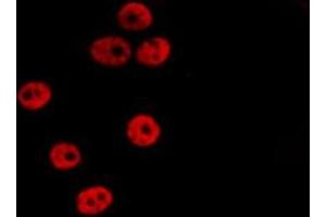 ABIN6275332 staining HepG2 by IF/ICC. (OGFR antibody  (Internal Region))