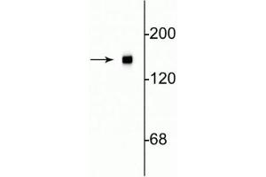 Western blot of rat cortical lysate showing specific immunolabeling of the ~145 kDa NF-M protein. (NEFM antibody  (C-Term))