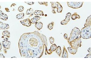 IHC analysis of MID1 using anti-MID1 antibody (ABIN6719400). (MID1 antibody  (AA 226-278))