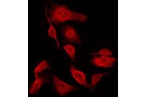ABIN6267294 staining HeLa by IF/ICC. (HSP27 antibody  (pSer15))
