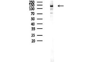 anti-Budding Uninhibited By Benzimidazoles 1 Homolog (Yeast) (BUB1) (pSer459) antibody