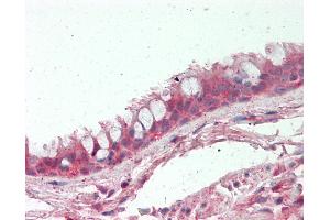 Human Lung, Respiratory Epithelium: Formalin-Fixed, Paraffin-Embedded (FFPE) (EDC3 antibody  (AA 25-75))