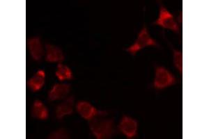 ABIN6274903 staining Hela by IF/ICC. (GCNT7 antibody  (Internal Region))