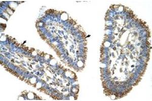 Immunohistochemical staining (Formalin-fixed paraffin-embedded sections) of human intestine with DIS3L2 polyclonal antibody  at 4-8 ug/mL working concentration. (DIS3L2 antibody  (N-Term))