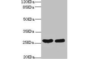 Western blot All lanes: CRP antibody at 2 μg/mL Lane 1: High values of serum at 1: 5 Lane 2: High values of serum at 1: 10 Secondary Goat polyclonal to rabbit IgG at 1/10000 dilution Predicted band size: 26, 11 kDa Observed band size: 26 kDa (CRP antibody  (AA 19-224))