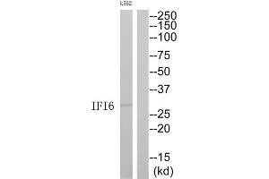 Western Blotting (WB) image for anti-Interferon, alpha-Inducible Protein 6 (IFI6) (C-Term) antibody (ABIN1852572) (IFI6 antibody  (C-Term))
