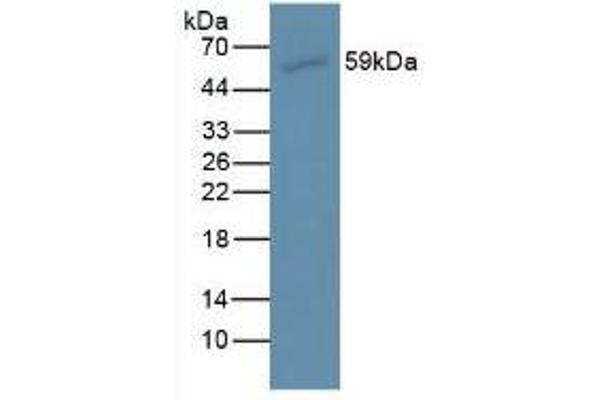 AMH antibody