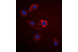 Immunofluorescent analysis of GPR75 staining in A549 cells. (GPR75 antibody  (C-Term))
