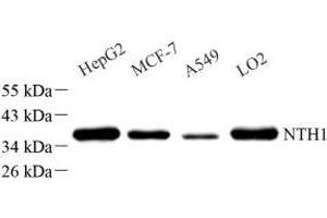 Western blot analysis of NTHL1 (ABIN7074866) at dilution of 1: 1000