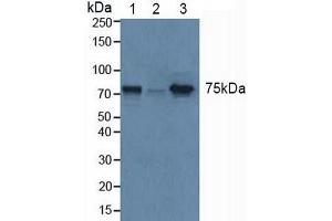 Figure. (GBA antibody  (AA 117-214))