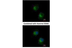 ICC/IF Image Immunofluorescence analysis of methanol-fixed HeLa, using IFIT3, antibody at 1:500 dilution. (IFIT3 antibody)