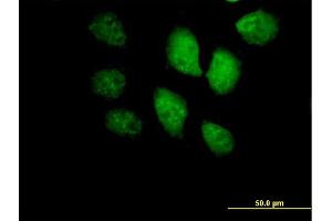 Immunofluorescence of purified MaxPab antibody to BRF1 on HeLa cell. (BRF1 antibody  (AA 1-473))