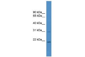 WB Suggested Anti-HOXB1 Antibody Titration:  0. (HOXB1 antibody  (C-Term))