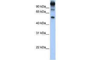 WB Suggested Anti-FEZF1 Antibody Titration:  1 ug/ml  Positive Control:  Hela cell lysate (FEZF1 antibody  (C-Term))