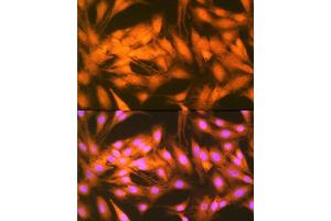 Immunofluorescence analysis of C6 cells using FGF1 Rabbit mAb (ABIN7267182) at dilution of 1:100 (40x lens). (FGF1 antibody)