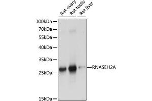Western blot analysis of extracts of various cell lines, using RNA antibody (ABIN7269981) at 1:1000 dilution. (RNASEH2A antibody  (AA 1-299))