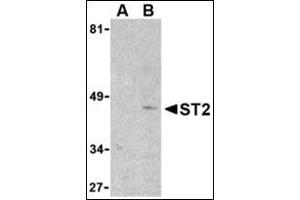 Western blot analysis of ST2 in mouse kidney lysate with this product at 1 μg/ml in the presence (lane A) or absence (lane B) of 1 μg blocking peptide.