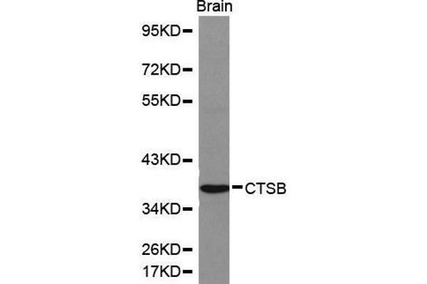 Cathepsin B antibody  (AA 1-339)