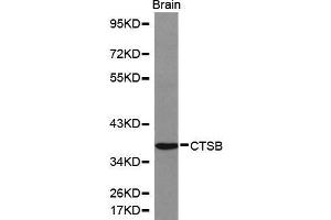 Western Blotting (WB) image for anti-Cathepsin B (CTSB) (AA 1-339) antibody (ABIN6214050) (Cathepsin B antibody  (AA 1-339))