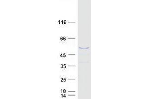 MAGEB4 Protein (Myc-DYKDDDDK Tag)