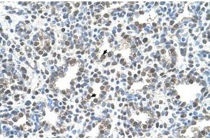 Immunohistochemical staining (Formalin-fixed paraffin-embedded sections) of human lung with MCM3 polyclonal antibody . (MCM3 antibody  (AA 726-775))