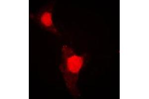 Immunofluorescent analysis of FOXO1 (pS319) staining in HeLa cells. (FOXO1 antibody  (pSer319))