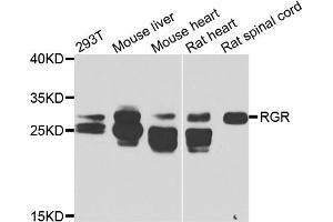 Western blot analysis of extracts of various cell lines, using RGR antibody (ABIN5975227) at 1/1000 dilution. (RGR antibody)