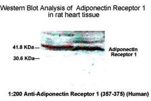 Western Blot Analysis of Adiponecitin Receptor 1 in rat heart tissue. (Adiponectin Receptor 1 antibody  (AA 357-375))