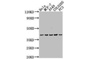 Western Blot Positive WB detected in: Hela whole cell lysate, MCF-7 whole cell lysate, A549 whole cell lysate, COLO205 whole cell lysate, PC-3 whole cell lysate All lanes: LPAR2 antibody at 1:2000 Secondary Goat polyclonal to rabbit IgG at 1/50000 dilution Predicted band size: 40 kDa Observed band size: 40 kDa
