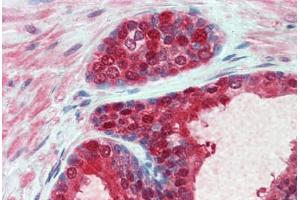 Human Prostate: Formalin-Fixed, Paraffin-Embedded (FFPE) (Cytidine Monophosphate (UMP-CMP) Kinase 1, Cytosolic (CMPK1) (AA 1-229) antibody)