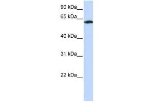 WB Suggested Anti-FBXO24 Antibody Titration:  0.
